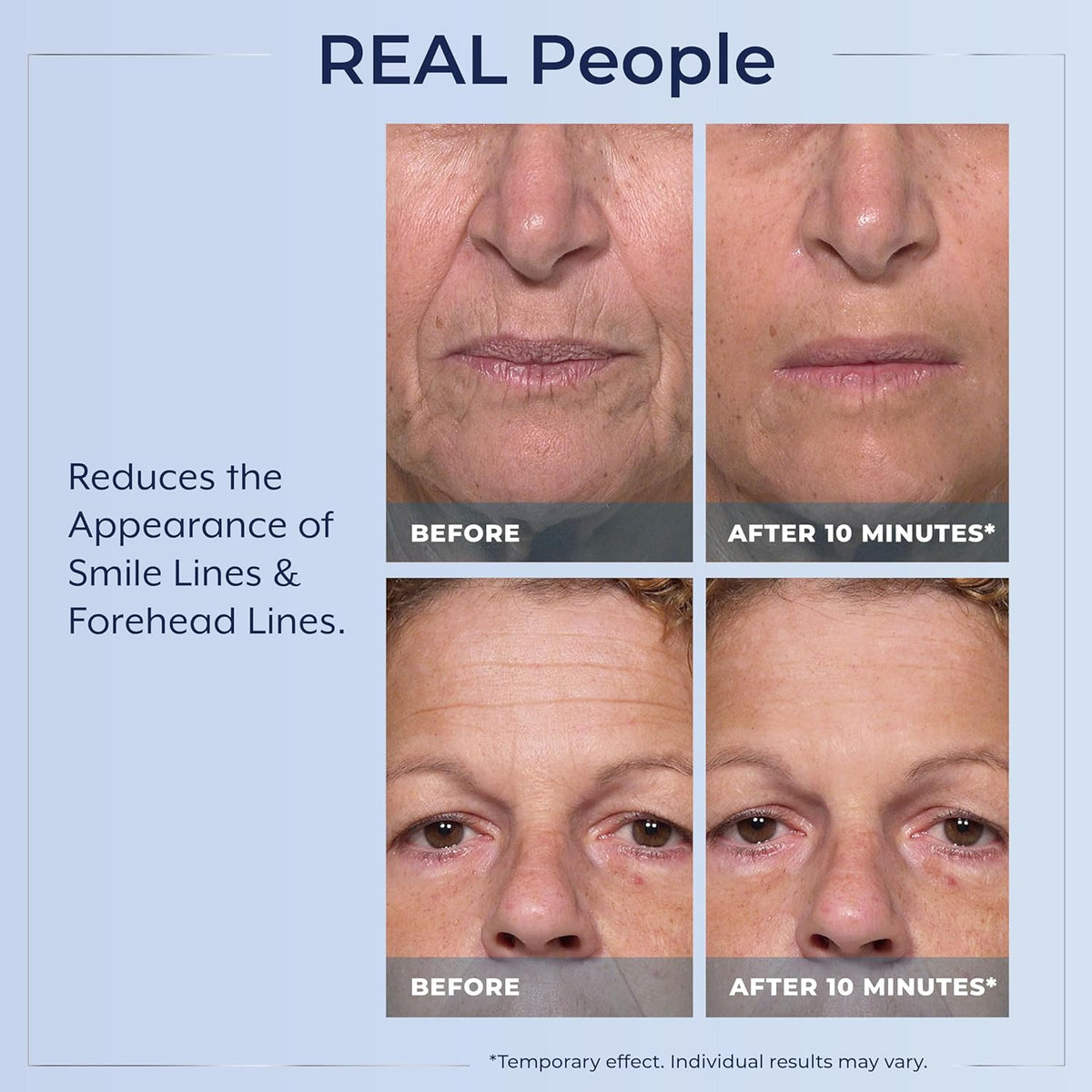 Plexaderm Rapid Reduction Serum - Visibly Reduces Under-Eye Bags & Wrinkles